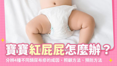 尿布疹