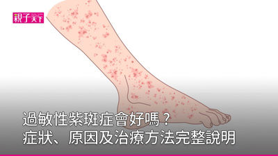 過敏性紫斑症