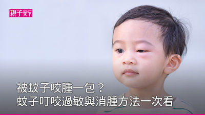 被蚊子咬腫很大硬硬的
