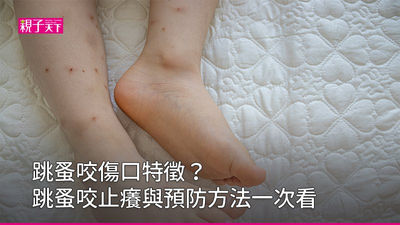 跳蚤咬-止癢-預防跳蚤